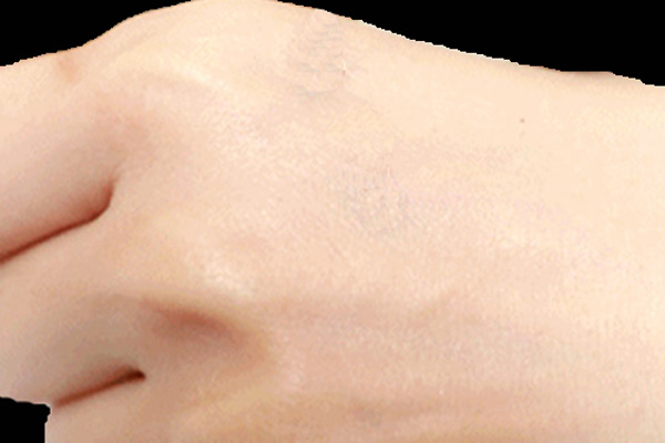 高光谱成像仪在医学诊断领域的几点应用